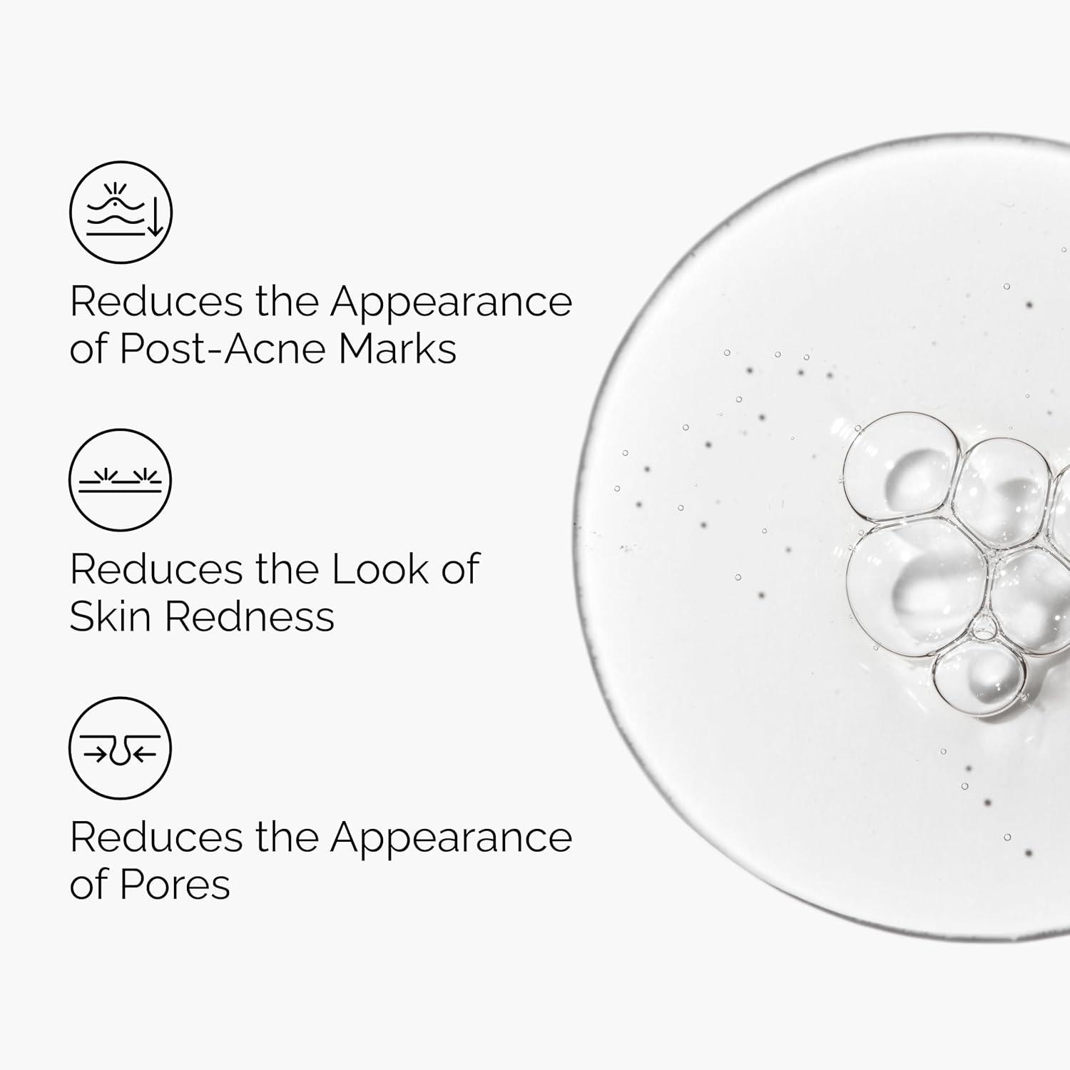 imageThe Ordinary Aloe 2 NAG 2 Solution Soothes Skin and Targets PostAcne Marks 1 Fl Oz