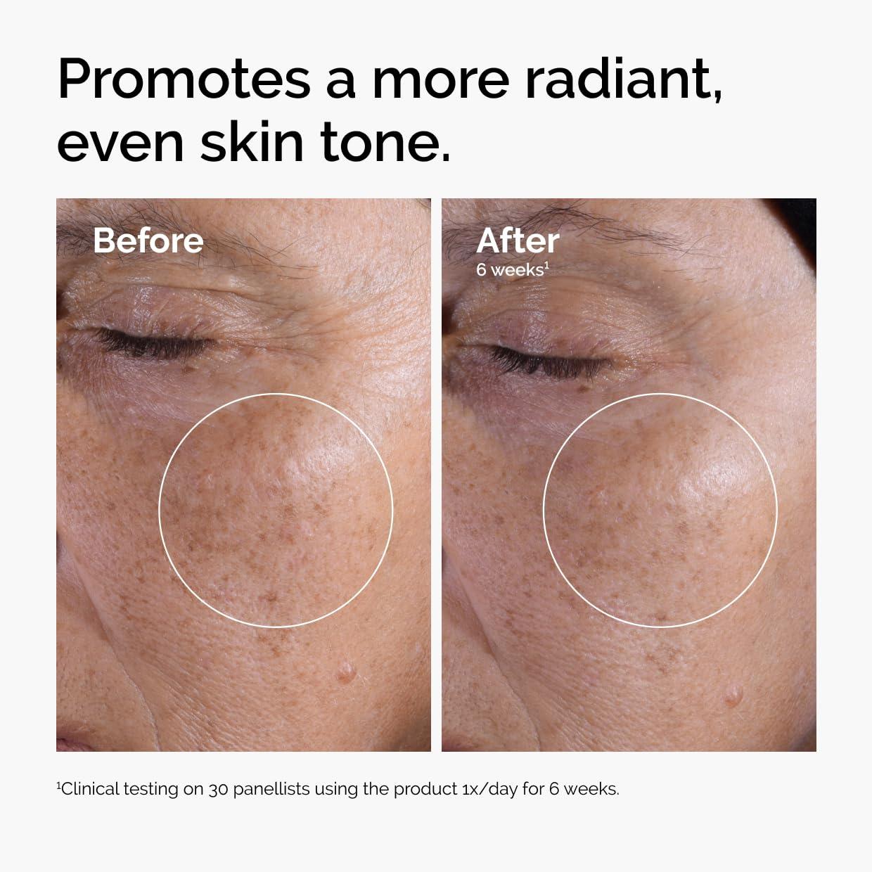 imageThe Ordinary Glycolic Acid 7 Exfoliating Toner Brightening and Smoothing Daily Toner for More EvenLooking Skin Tone34 Fl Oz Pack of 2