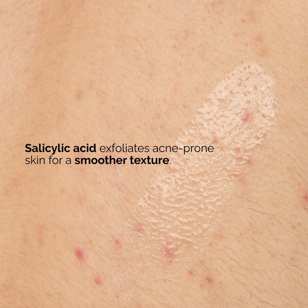 imageThe Ordinary Salicylic Acid 05 Body Serum Exfoliating Treatment for AcneProne Skin 81 Fl Oz