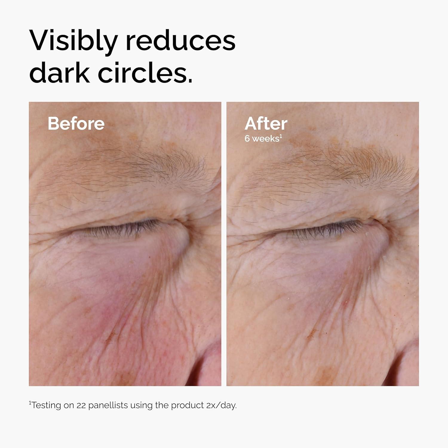 imageThe Ordinary Caffeine Solution 5 EGCG Depuffing Eye Serum for Dark Circles and Tired Eyes1 Fl Oz Pack of 1