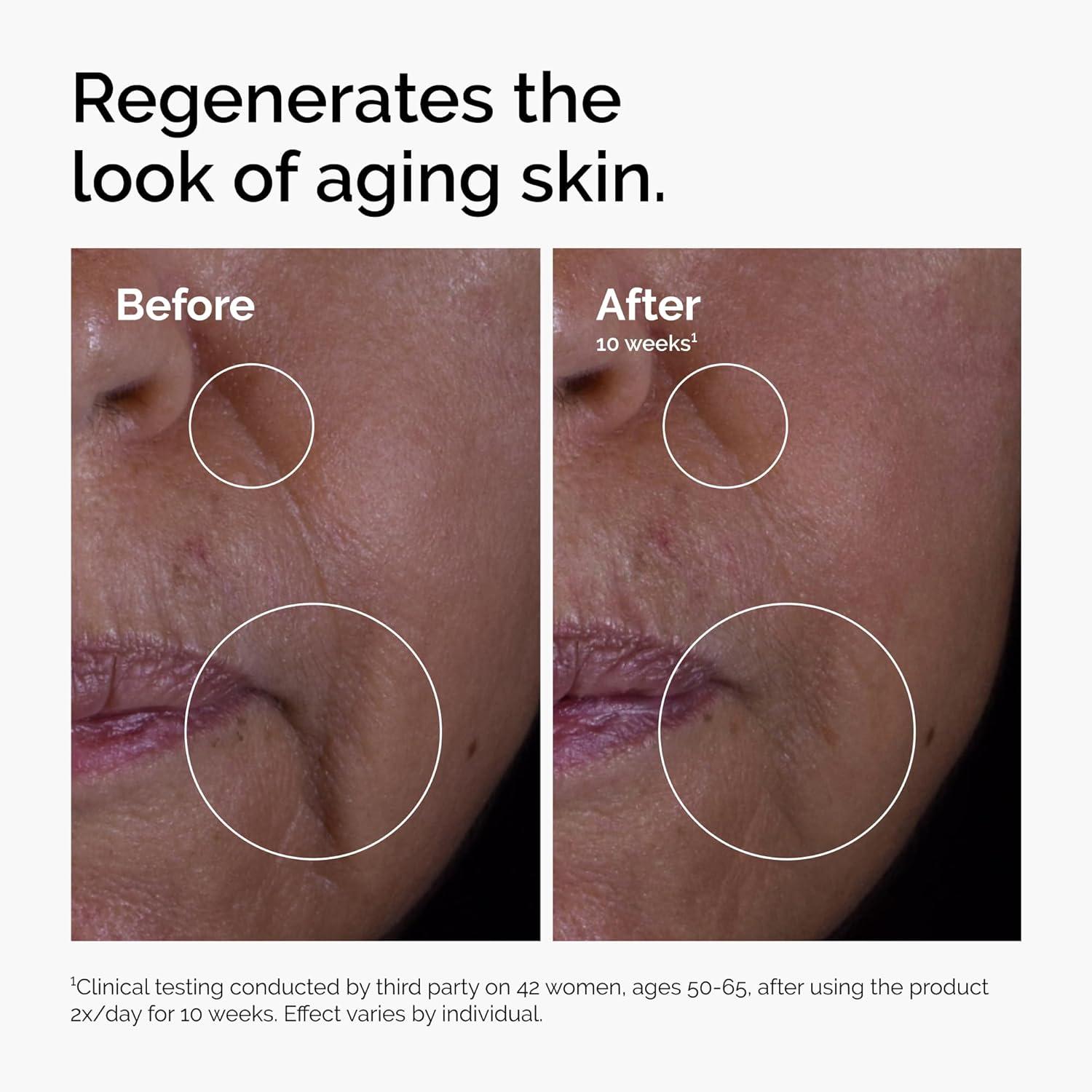 imageThe Ordinary GF 15 Solution AntiAging Formula for Visible Skin amp Wrinkle Repair 1 Fl Oz