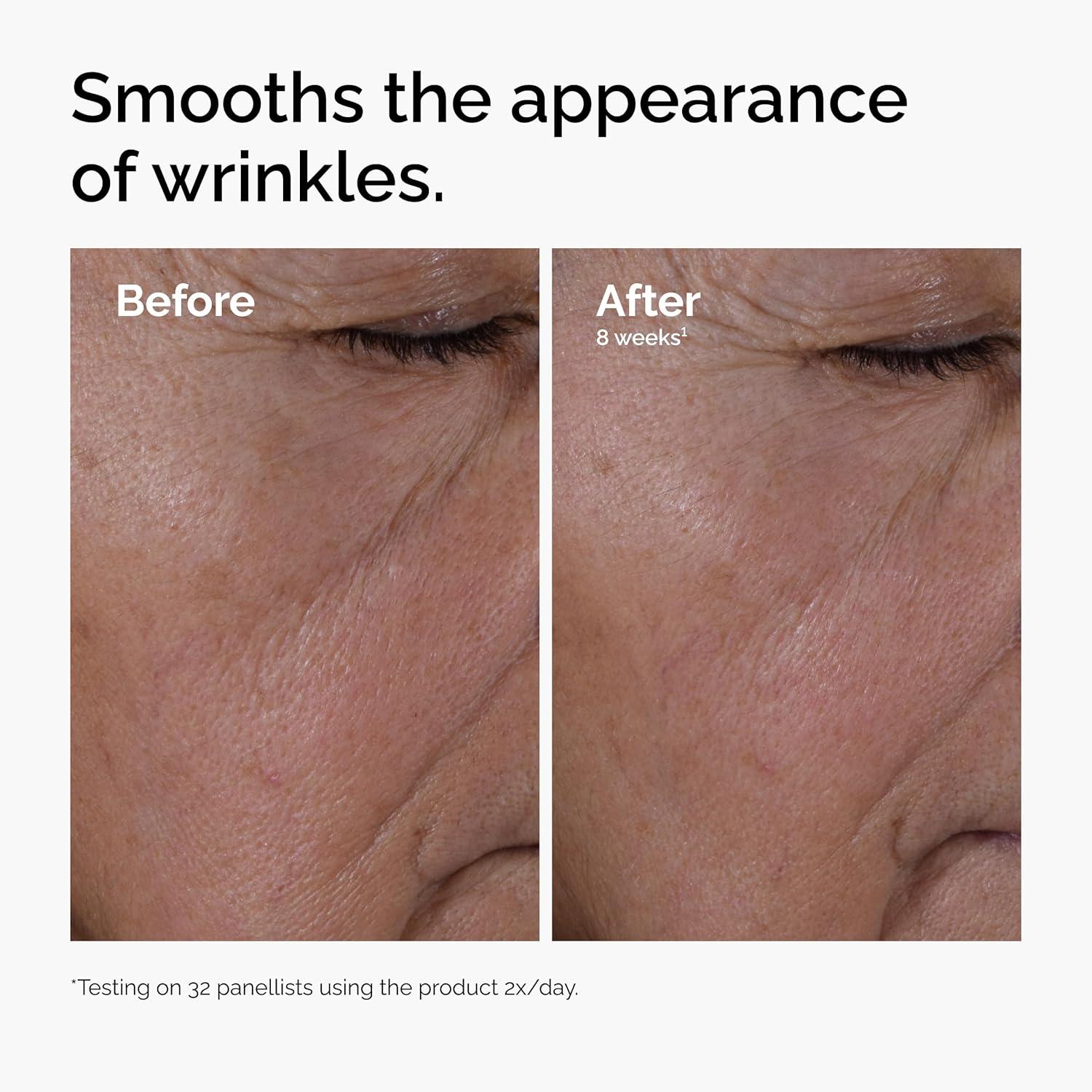 imageThe Ordinary MultiPeptide Hyaluronic Acid AntiAging Peptide Serum for Crows Feet Elasticity amp Firmness 1 Fl Oz