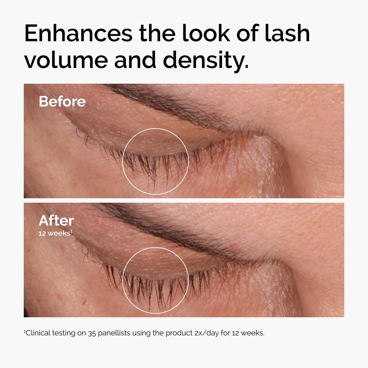 imageThe Ordinary MultiPeptide Lash and Brow Serum PeptidePowered Formula for Thicker Fuller Looking Lashes amp Brows016 Fl Oz Pack of 1