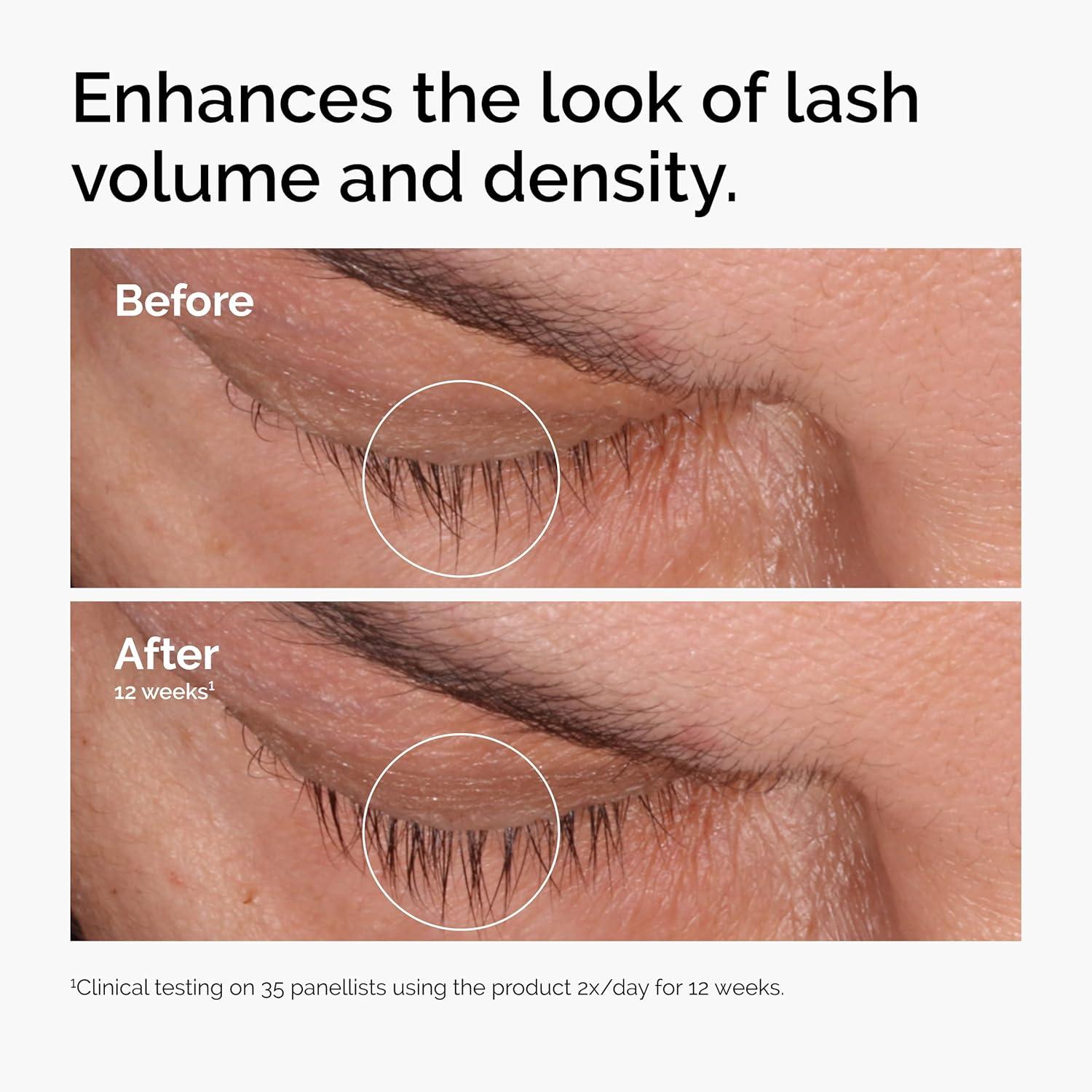imageThe Ordinary MultiPeptide Lash and Brow Serum PeptidePowered Formula for Thicker Fuller Looking Lashes amp Brows016 Fl Oz Pack of 2