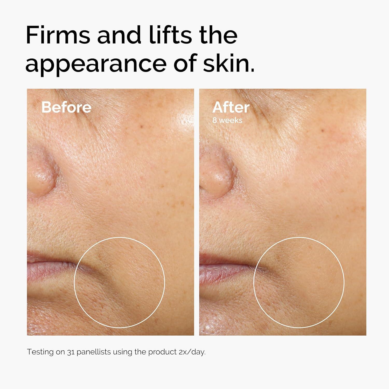 imageThe Ordinary Caffeine 3 Escin 1 Face Serum Energizing Serum to Tone and Tighten 1 Fl Oz