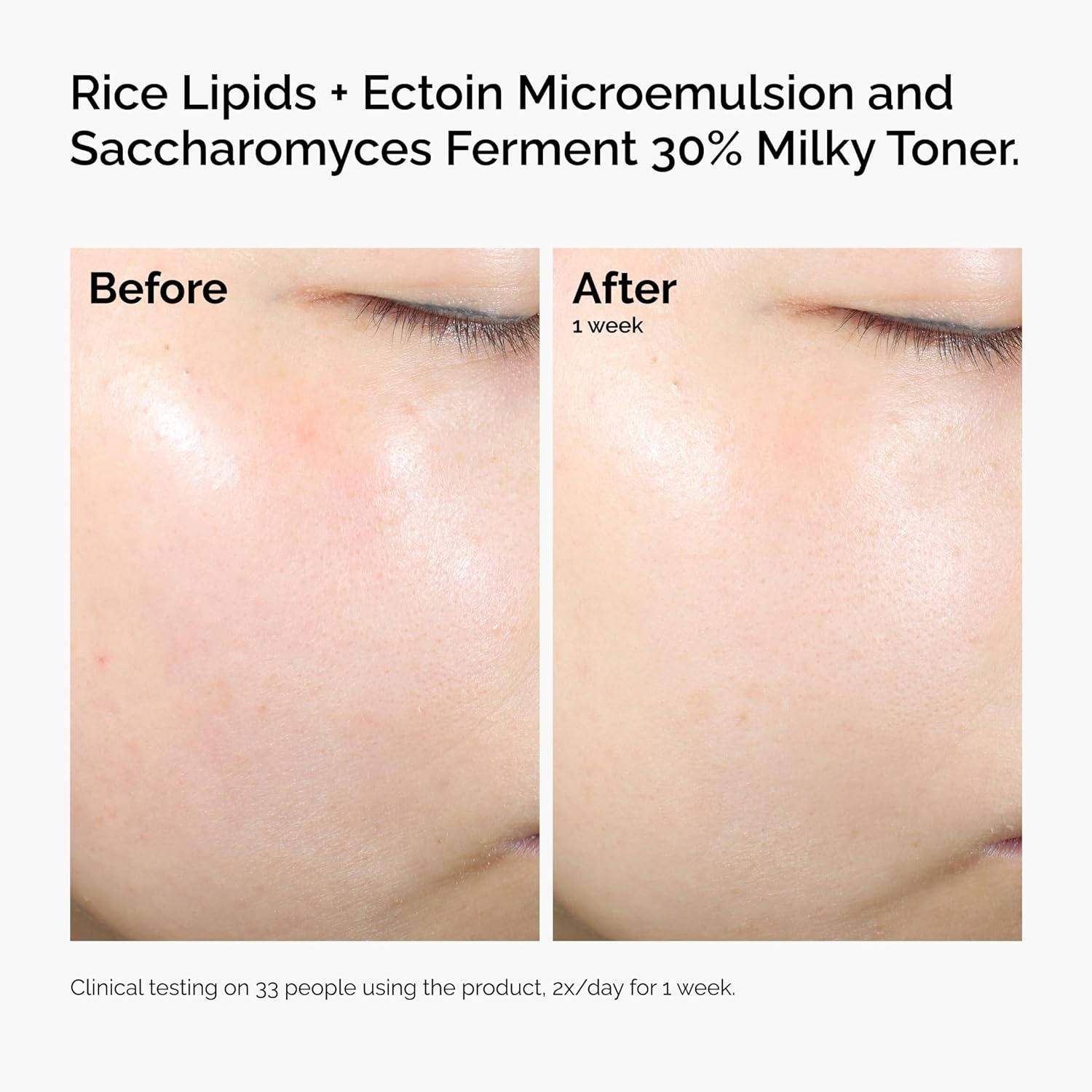 imageThe Ordinary Rice Lipids Ectoin Microemulsion Moisturizer for Dry Skin Soothing Hydration Barrier Repair Reduced Redness4 Fl Oz Pack of 1