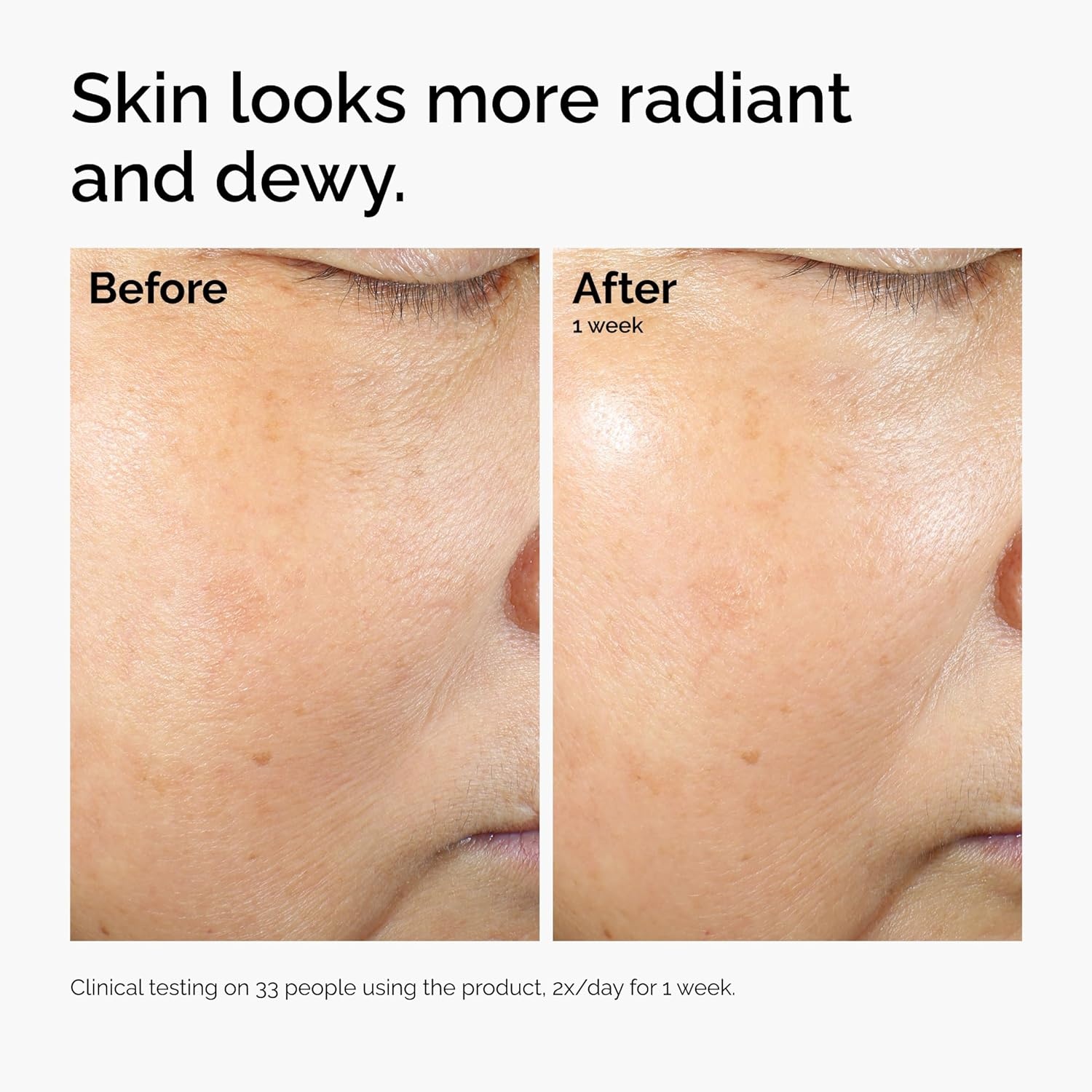 imageThe Ordinary Rice Lipids Ectoin Microemulsion Moisturizer for Dry Skin Soothing Hydration Barrier Repair Reduced Redness4 Fl Oz Pack of 1