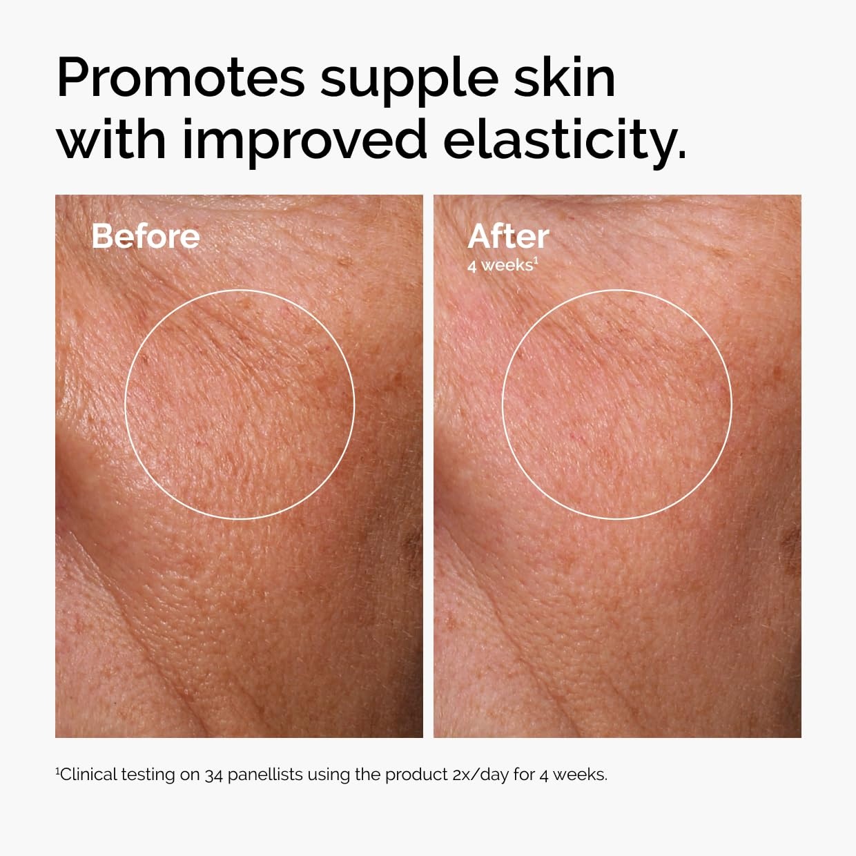 imageThe Ordinary The Mini Icons Set Travel Size Skin Care to Hydrate and Brighten Glycolic Acid 7 Exfoliating Toner Niacinamide 10 Zinc 1 Hyaluronic Acid 2 B5 with Reusable Cotton Pads